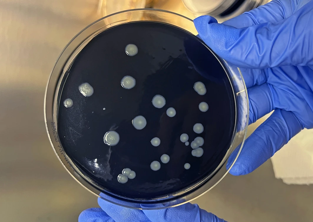 Legionella